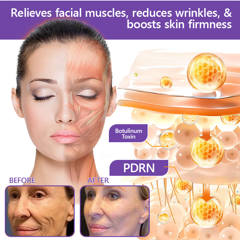 ca Canada Compliant : HISKIN® PDRN Multi-Peptide Massaging Body Roller Cream- Anti-aging, Hydrating, Skin Firming & Lifting, Skin Repair, Even Tone, Acne and Dark Spot Treatment, Wart and Mole Removal, and Psoriasis Relief.
