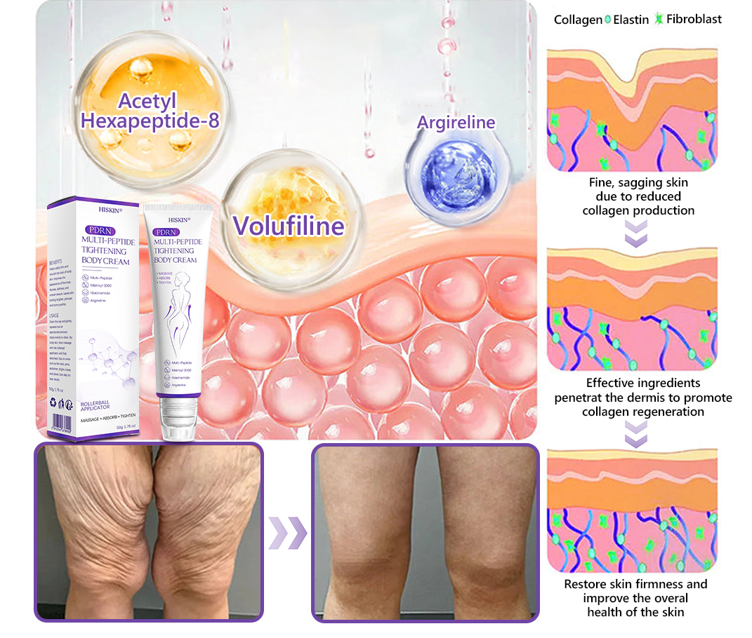 ca Canada Compliant : HISKIN® PDRN Multi-Peptide Massaging Body Roller Cream- Anti-aging, Hydrating, Skin Firming & Lifting, Skin Repair, Even Tone, Acne and Dark Spot Treatment, Wart and Mole Removal, and Psoriasis Relief.
