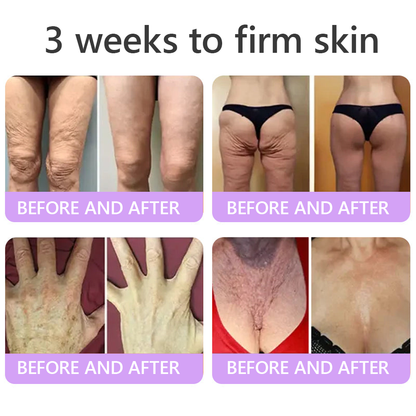 ca Canada Compliant : HISKIN® PDRN Multi-Peptide Massaging Body Roller Cream- Anti-aging, Hydrating, Skin Firming & Lifting, Skin Repair, Even Tone, Acne and Dark Spot Treatment, Wart and Mole Removal, and Psoriasis Relief.