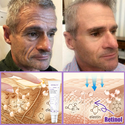ca Canada Compliant : HISKIN® PDRN Multi-Peptide Massaging Body Roller Cream- Anti-aging, Hydrating, Skin Firming & Lifting, Skin Repair, Even Tone, Acne and Dark Spot Treatment, Wart and Mole Removal, and Psoriasis Relief.